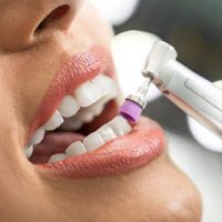 Mit einem Zahnmedizinischen Ger&auml;t werden die Z&auml;hne poliert.