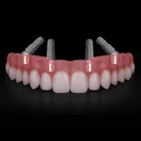 Zahnimplantat der oberen Zahnreihe