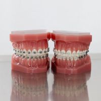 Zwei Gebiss-Modelle mit je verschiedenen Zahnspangen stehen auf einem spiegelnden Untergrund.