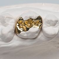 Kleine Restauration eines Backenzahns mit Gold-Inlay auf einem Zahnmodell.