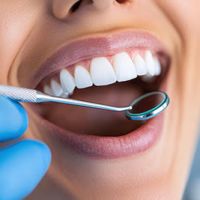 Mit Hilfe eines kleinen Spiegels wird der Zustand der Z&auml;hne kontrolliert.