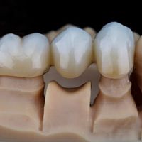 Modell einer Br&uuml;cke.